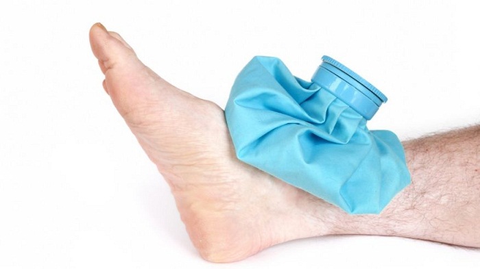 Should you ice a sprained ankle? 